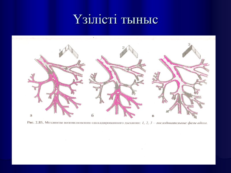 Үзілісті тыныс